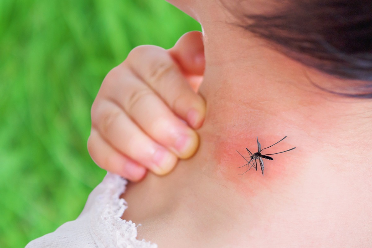 Врач дала рекомендации при комариных укусах у ребенка
